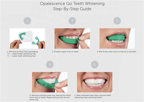 How to Use Opalescence Tooth Whitening - Baird Orthodontics | Pleasanton CA