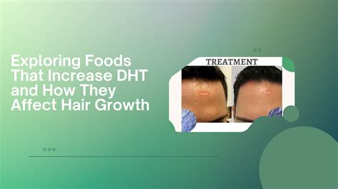 Exploring Foods That Increase DHT and How They Aff..