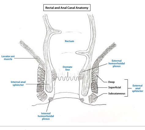 List 96+ Pictures Pictures Of Perianal Fistulas In Dogs Stunning