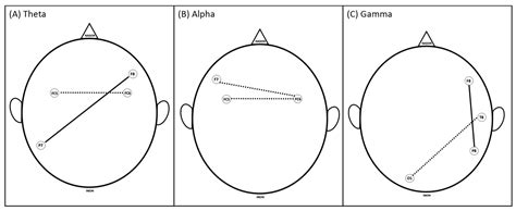 Neurocognitive Correlates of Clinical Decision Making: A Pilot Study ...