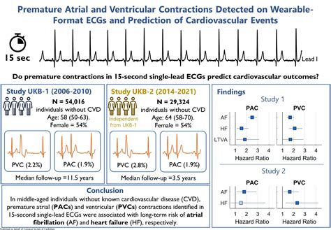 Premature Atrial Contractions Vs Premature Ventricular Contractions