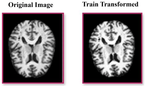 Hybrid Deep Learning Architecture with Adaptive Feature Fusion for ...