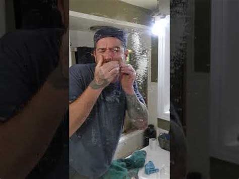 Largest Exploding Cyst 的图像结果