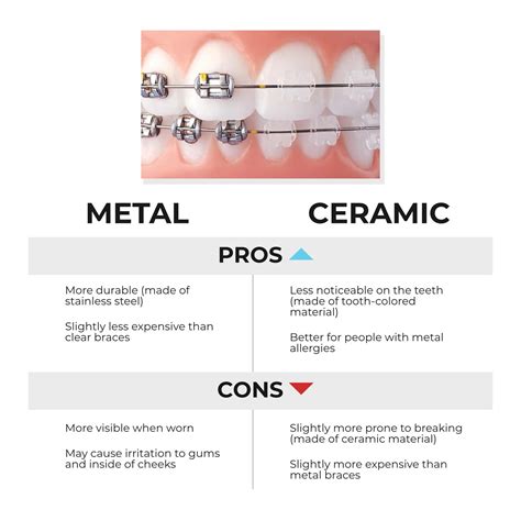 Ceramic Braces vs. Metal Braces: Pros, Cons, and Cost