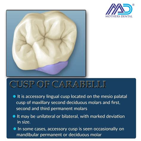 Where Is The Cusp Of Carabelli Located at Ollie Dunlap blog