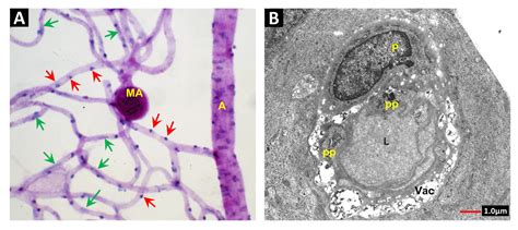 Radiation and Diabetic Retinopathy: A Dark Synergy