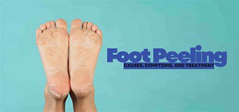 Foot Skin Peeling: Hidden Triggers And Simple At-Home Solutions