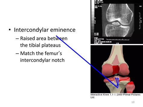Kin191 A.Ch.6.Knee.Patellofemoral.Anatomy | PPT