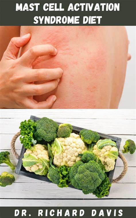 Mast Cell Activation Syndrome Diet Low Histamine Diet To Help ...