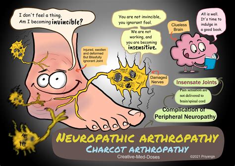 Neuropathic arthropathy: Charcot arthropathy - Creative Med Doses
