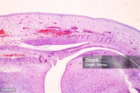 Image result for Finger Under Microscope