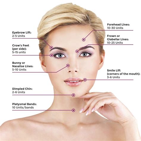 Common areas for botox injection and appropriate units per injection site | Botox cosmetic ...