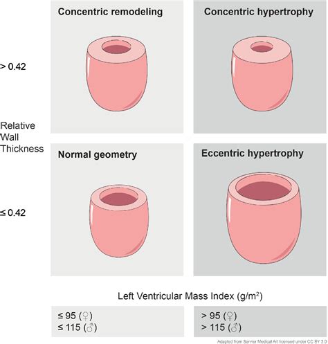 Concentric vs. eccentric remodelling in heart failure with reduced ...