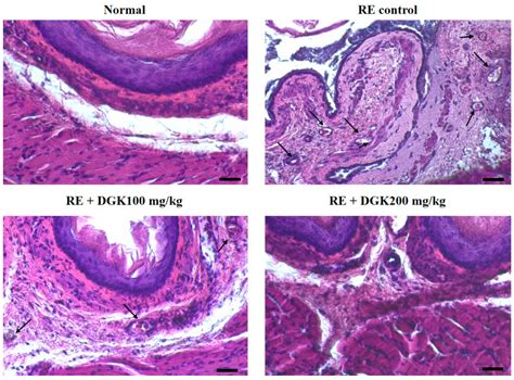 Dichloromethane Extracts of Geranium Koreanum Kom. Alleviates Esophagus ...