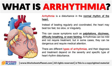 Arrhythmia Definition 的图像结果