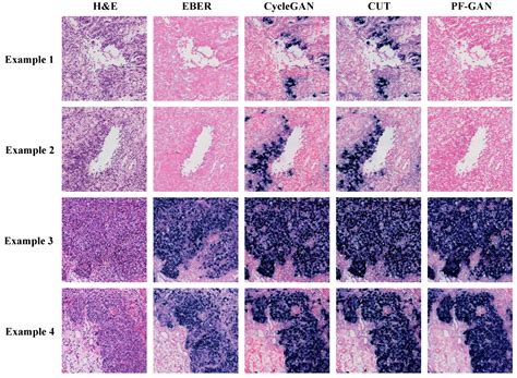 Automatic Annotation Diagnostic Framework for Nasopharyngeal Carcinoma ...