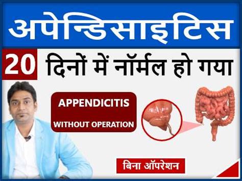अपेंडिक्स | appendicitis treatment | appendicitis treatment without ...