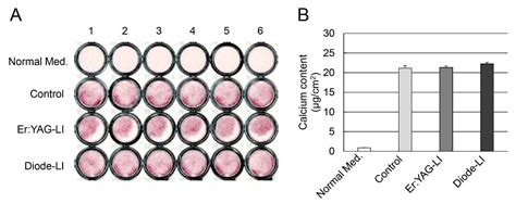 Effects of Er:YAG and Diode Laser Irradiation on Dental Pulp Cells and ...