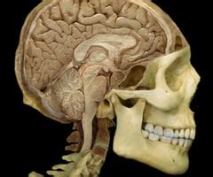 HN, NEU: Brain Lateral and Inferior Cranial nerves Flashcards | Quizlet