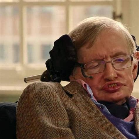 霍金去世，享年76岁，关于ALS疾病你了解多少