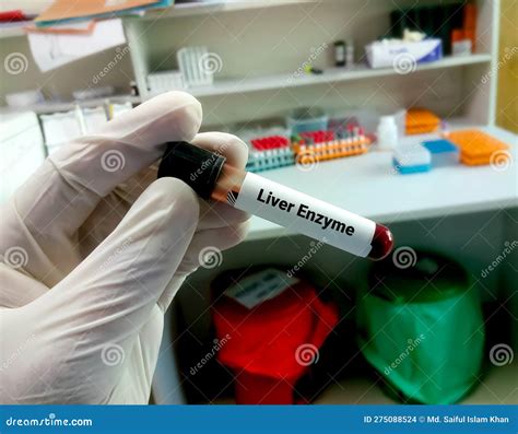 Image result for Liver Enzyme Lab Test