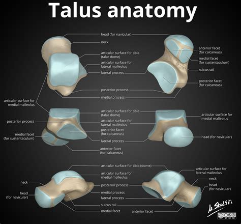 Talus Fracture X Ray View at Luca Glossop blog