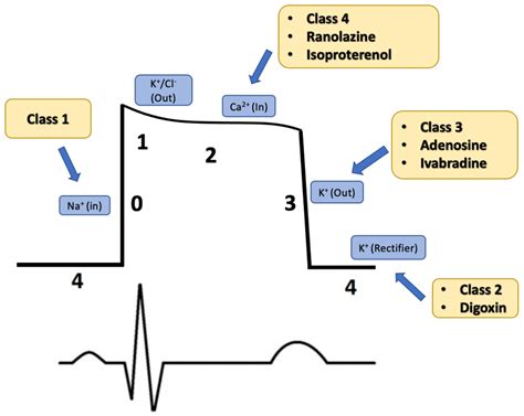 Rezultat imagine pentru V-fib Algorithm