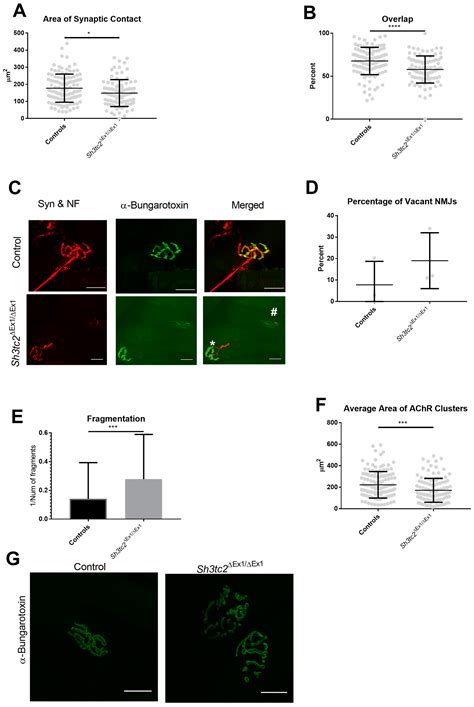 Neuromuscular Junction Changes in a Mouse Model of Charcot-Marie-Tooth ...