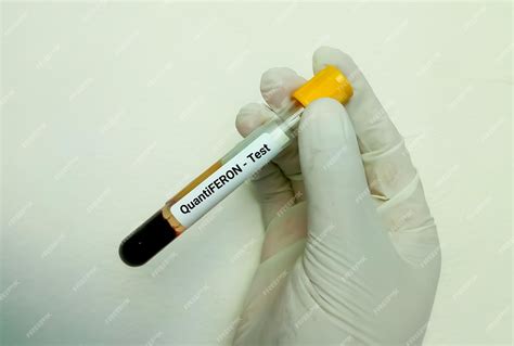 Premium Photo | Test tube with blood sample for quantiferon tb gold ...