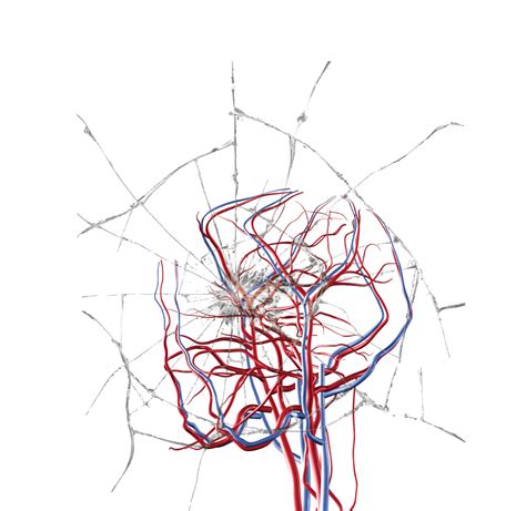 Stroke vs. Aneurysm: Treatment Options - SAFE