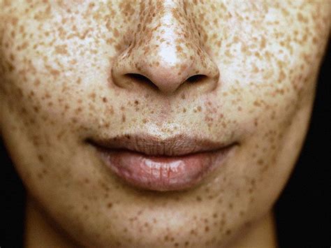 Image result for Exploding Nose