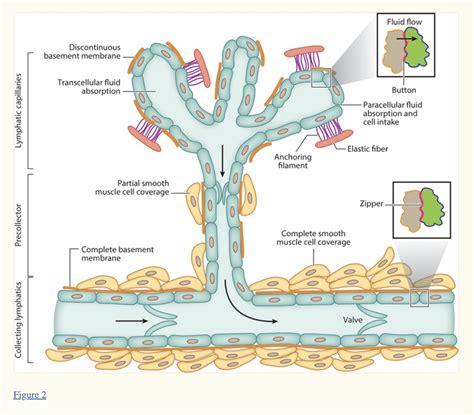 Lymphedema: Causes and Genetic Pathways