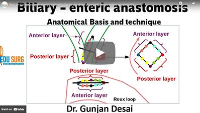 Surgery Videos - Gall Bladder and Bile Duct | EduSurg