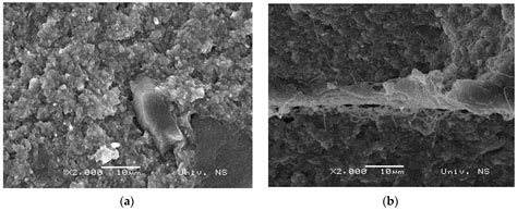 Development of Light-Polymerized Dental Composite Resin Reinforced with ...