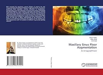 Maxillary Sinus Floor Augmentation : Amit Goel: Amazon.in: Books