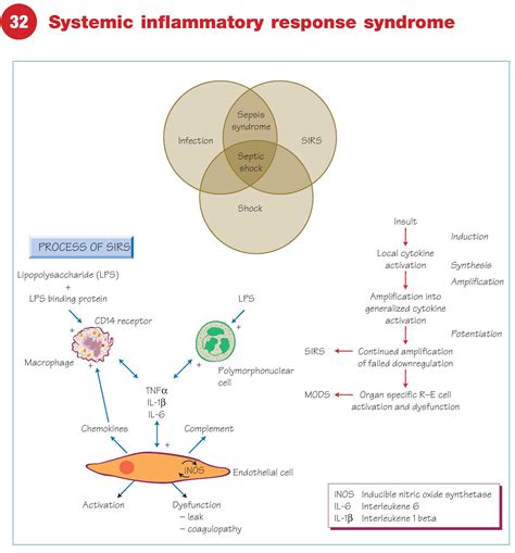 Systemic Inflammatory Response Syndrome (SIRS)