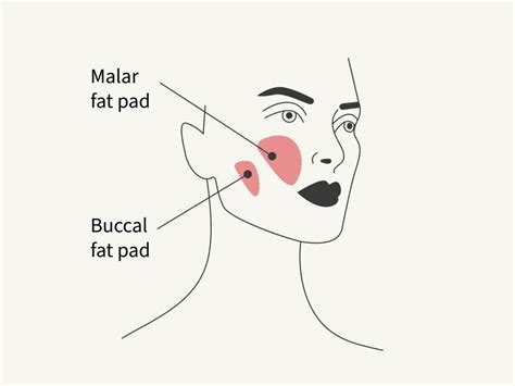 What is buccal fat removal? Experts explain the real…