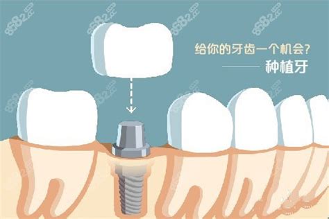 牙科行业资讯 - 口腔新资讯 - 牙齿矫正网