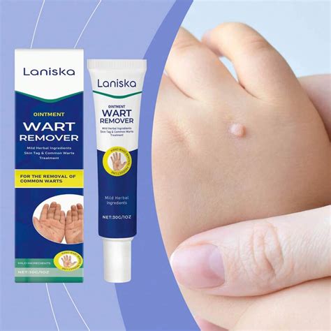 Laniska Herbal Wart Body Gentle Cleansing Smooth Skin Hand And Foot ...