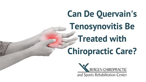 Can De Quervain's Tenosynovitis Be Treated by Chiropractors?