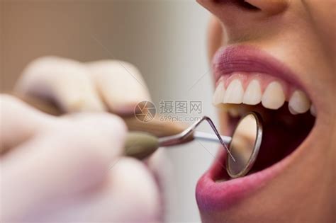 咨询约定在牙科诊所用工具检查一名女病人的牙科医生近距离检查探测高清图片下载-正版图片307815752-摄图网