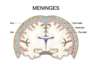 Bacterial meningitis is on the rise