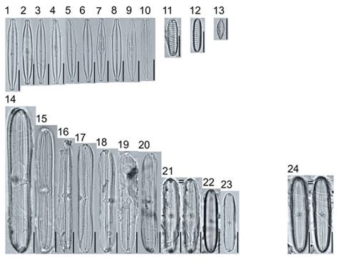 Water | Special Issue : Freshwater and/or Brackish Diatoms: Ecology and ...