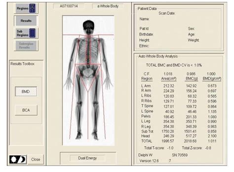 Image result for Total Body Scan