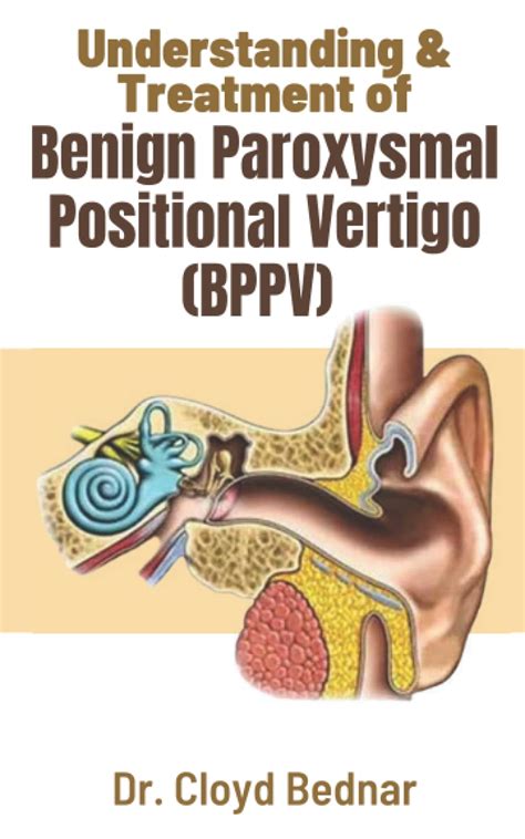 Buy Understanding & of Benign Paroxysmal Positional (BPPV): Symptoms ...
