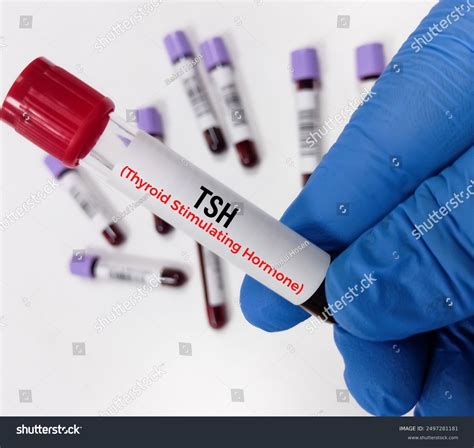 Blood Sample Thyroid Function Tests Tshthyroid Stock Photo 2497281181 | Shutterstock