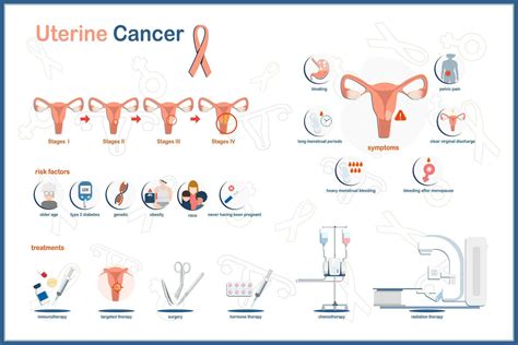 Medical vector illustration, uterine cancer infographic. Symptoms of uterine cancer, risk ...