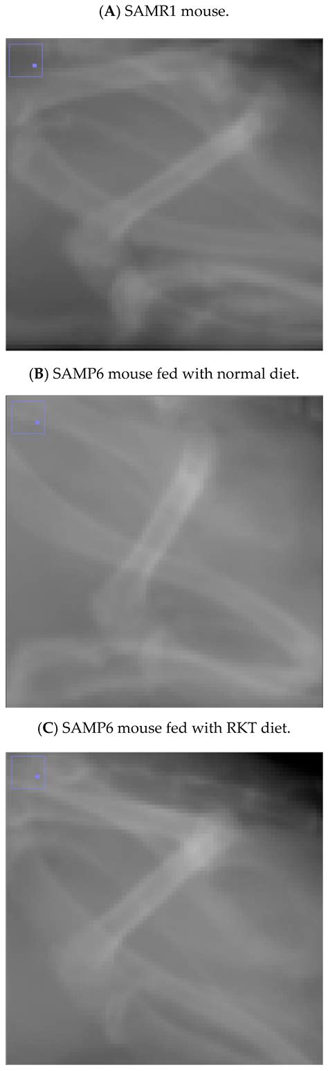 Prevention of Osteoporosis in SAMP6 Mice by Rikkunshi-To: Japanese ...