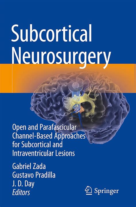 Buy Subcortical Neurosurgery: Open and Parafascicular Channel-Based ...