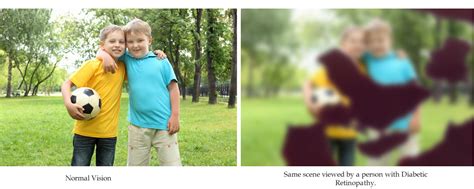 Image result for 20 400 Vision Example